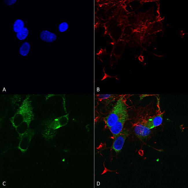 CaV1.3 Antibody in Immunocytochemistry (ICC/IF)