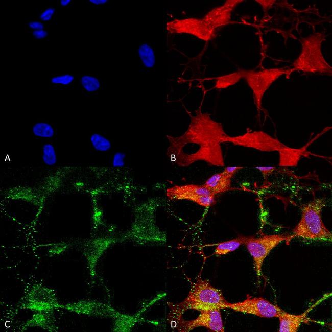 TRPV3 Antibody in Immunocytochemistry (ICC/IF)