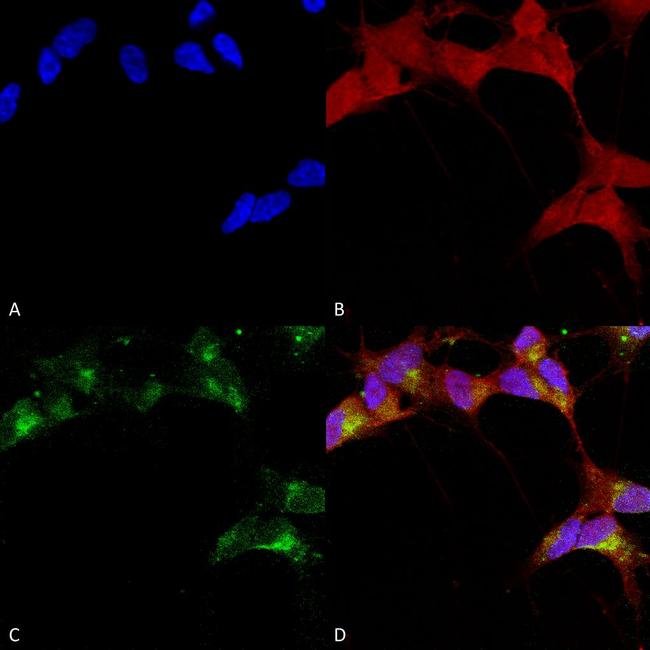 GABRB3 Antibody in Immunocytochemistry (ICC/IF)