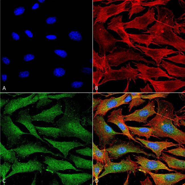 ATP7A Antibody in Immunocytochemistry (ICC/IF)