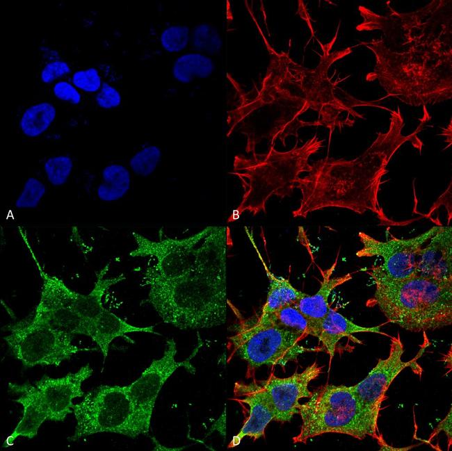 SLC38A1 Antibody in Immunocytochemistry (ICC/IF)