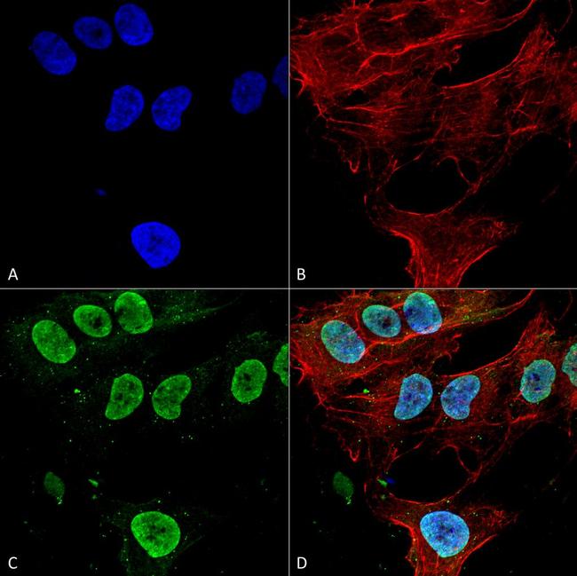 CaV3.1 Antibody in Immunocytochemistry (ICC/IF)