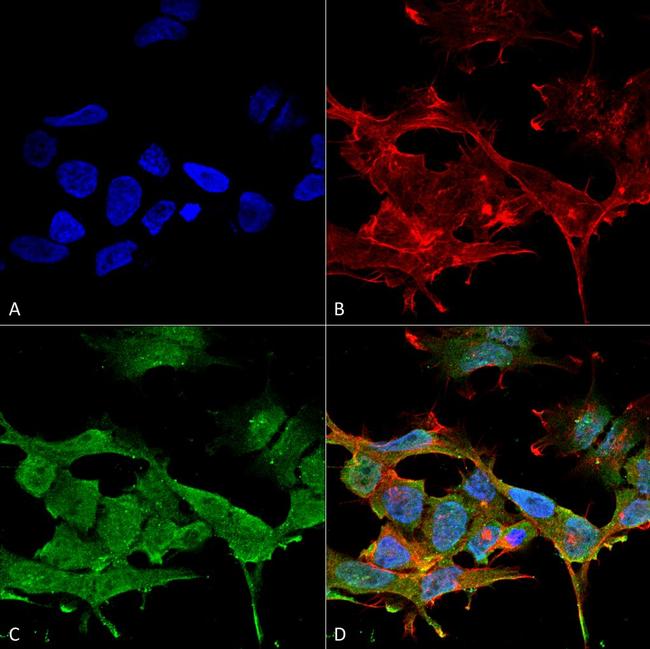 CLCN3 Antibody in Immunocytochemistry (ICC/IF)