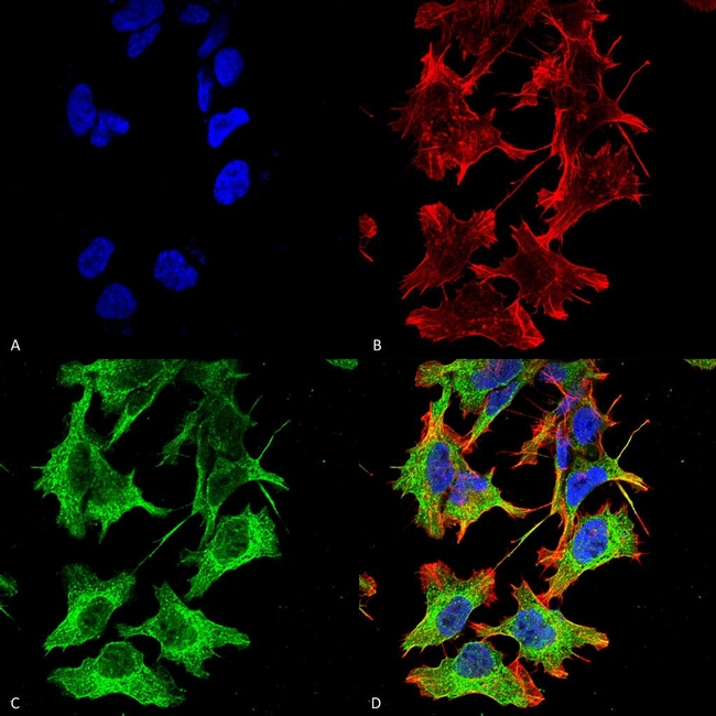 NMDAR1 Antibody in Immunocytochemistry (ICC/IF)