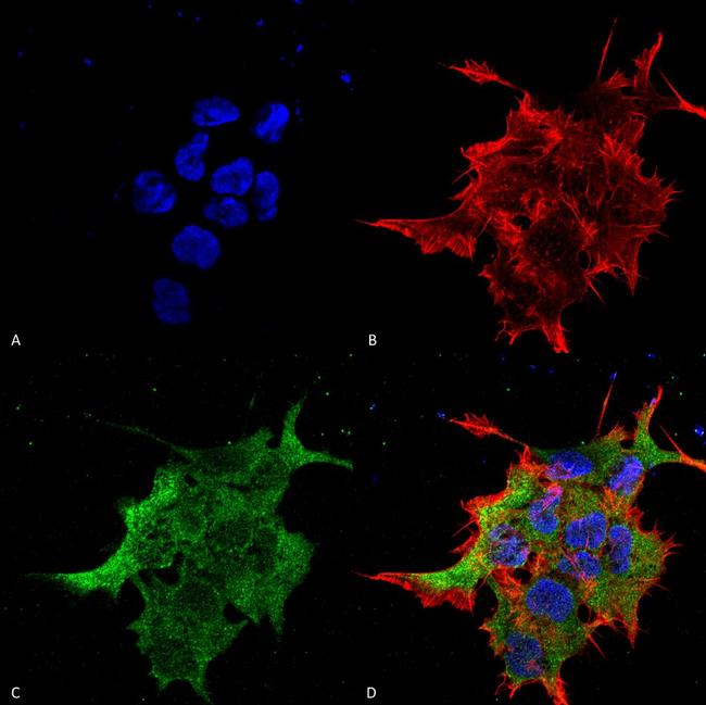 NALCN Antibody in Immunocytochemistry (ICC/IF)