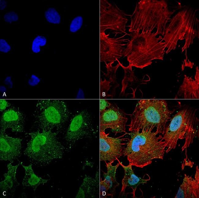 mGluR1/mGluR5 Antibody in Immunocytochemistry (ICC/IF)