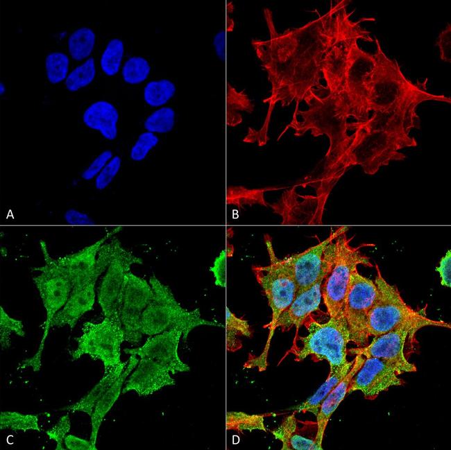 ASIC1 Antibody in Immunocytochemistry (ICC/IF)