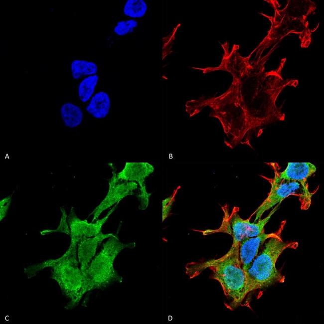 PINK1 Antibody in Immunocytochemistry (ICC/IF)