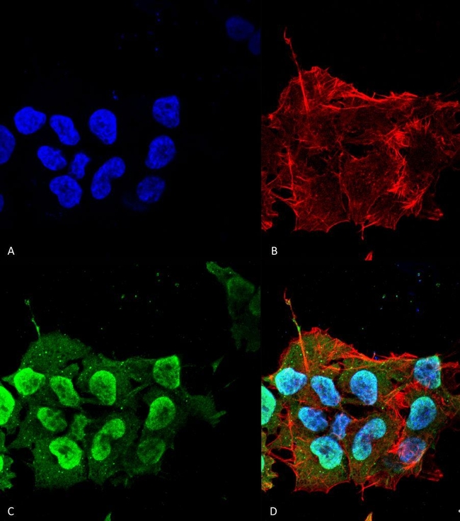 Ataxin 1 Antibody in Immunocytochemistry (ICC/IF)