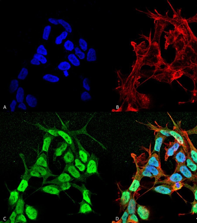 SCN3B Antibody in Immunocytochemistry (ICC/IF)