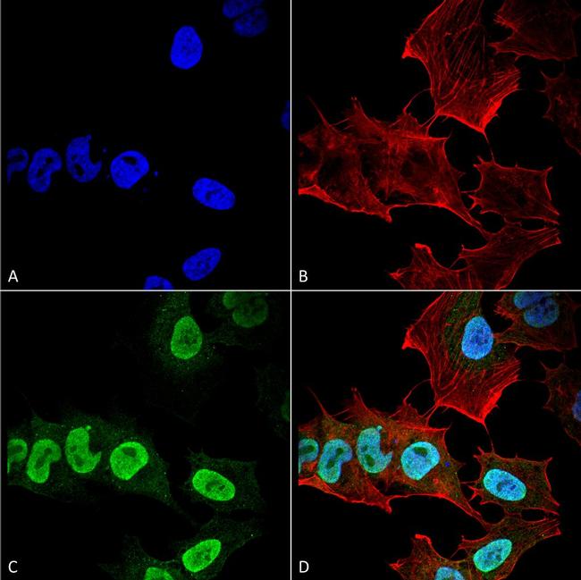 alpha Synuclein Antibody in Immunocytochemistry (ICC/IF)