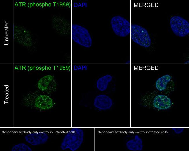 Phospho-ATR (Thr1989) Antibody in Immunocytochemistry (ICC/IF)