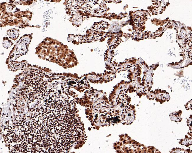 SETD1A Antibody in Immunohistochemistry (Paraffin) (IHC (P))