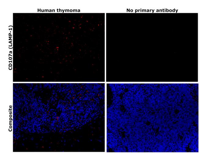 LAMP1 Antibody in Immunohistochemistry (Paraffin) (IHC (P))