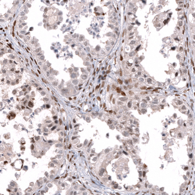 TFE3 Antibody in Immunohistochemistry (Paraffin) (IHC (P))