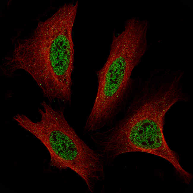 TFE3 Antibody in Immunocytochemistry (ICC/IF)