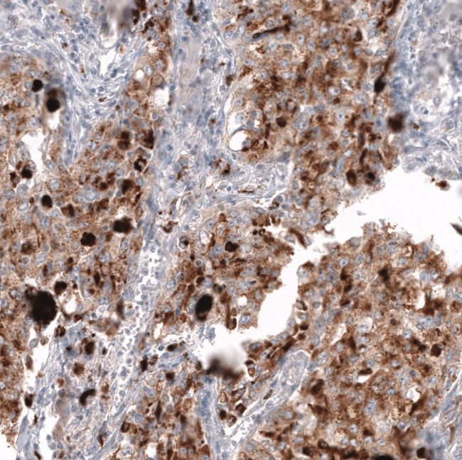 NAPSA Antibody in Immunohistochemistry (Paraffin) (IHC (P))