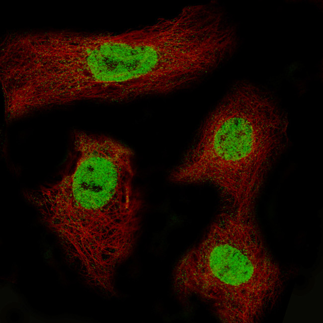 CDX2 Antibody in Immunocytochemistry (ICC/IF)