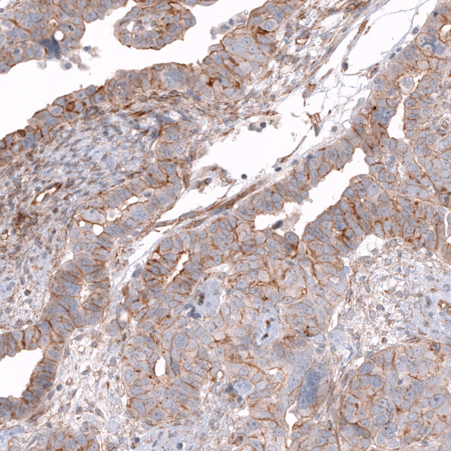 Glypican 3 Antibody in Immunohistochemistry (Paraffin) (IHC (P))