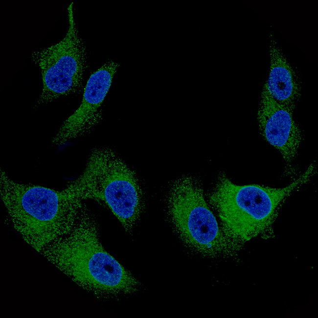 Melan-A Antibody in Immunocytochemistry (ICC/IF)