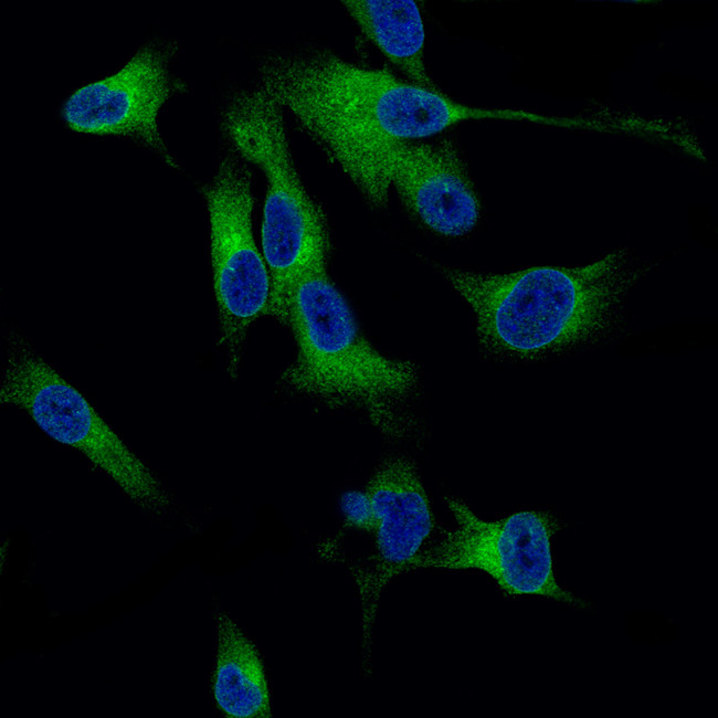 Melan-A Antibody in Immunocytochemistry (ICC/IF)