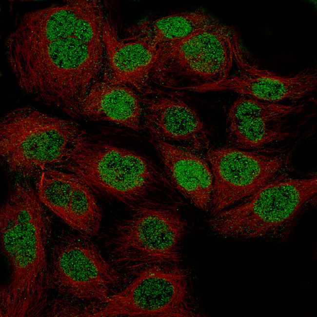 WT1 Antibody in Immunocytochemistry (ICC/IF)