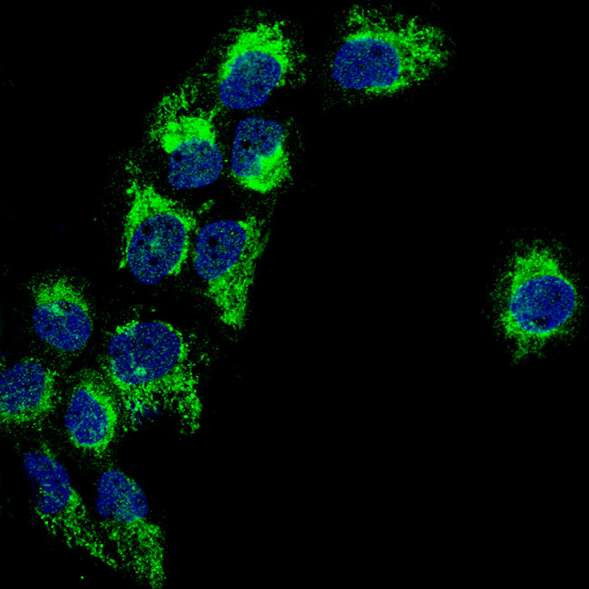 TSPO Antibody in Immunocytochemistry (ICC/IF)