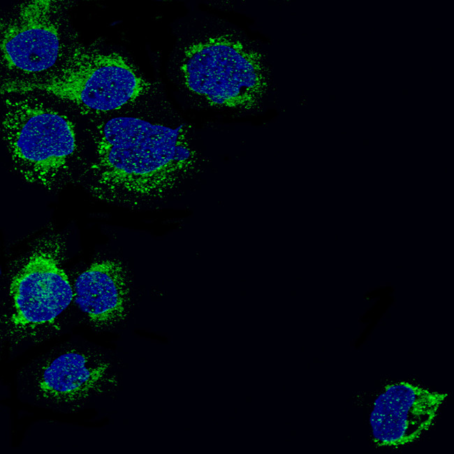 TSPO Antibody in Immunocytochemistry (ICC/IF)