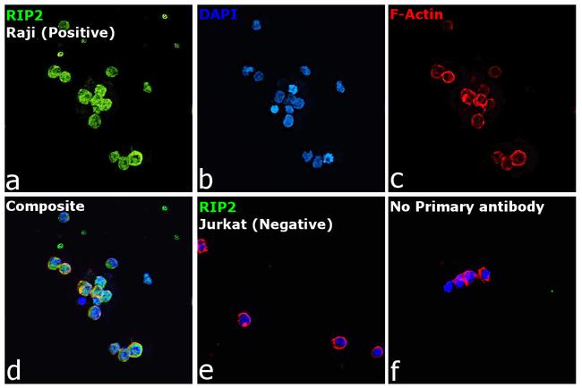 RIP2 Antibody in Immunocytochemistry (ICC/IF)