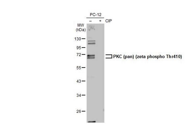 Phospho-PKC zeta (Thr410) Antibody in Western Blot (WB)