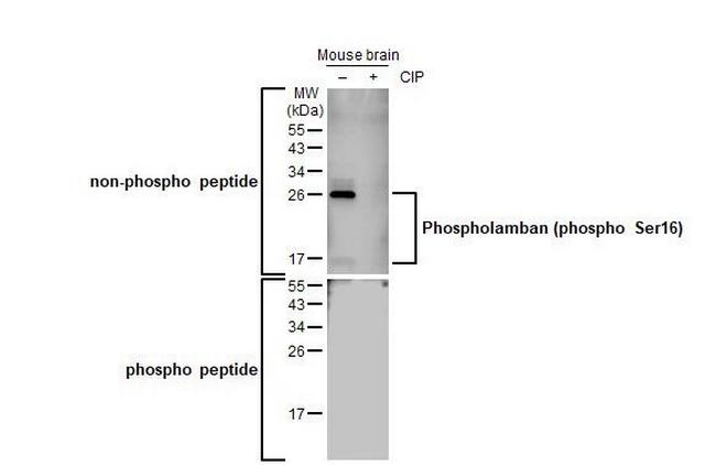 Phospho-Phospholamban (Ser16) Antibody in Western Blot (WB)