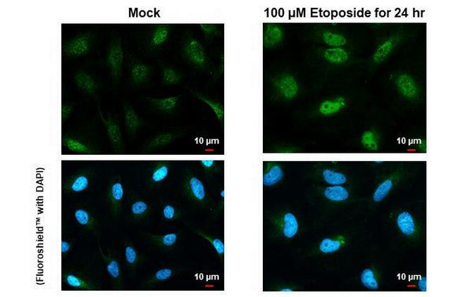 Phospho-ATR (Thr1989) Antibody in Immunocytochemistry (ICC/IF)