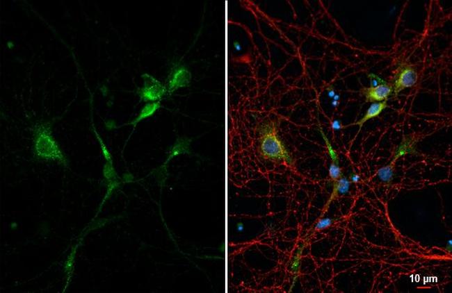 C9orf72 Antibody in Immunocytochemistry (ICC/IF)