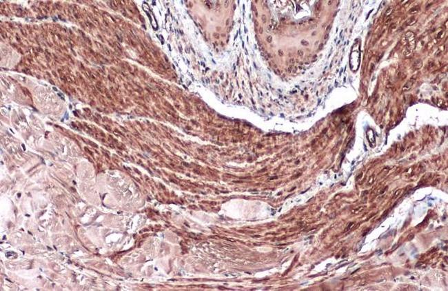 Vinculin Antibody in Immunohistochemistry (Paraffin) (IHC (P))