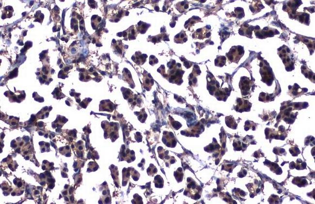 ATM Antibody in Immunohistochemistry (Paraffin) (IHC (P))