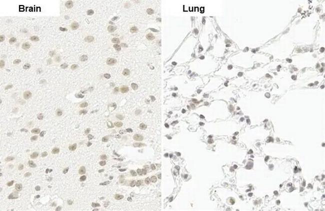 POLR2B Antibody in Immunohistochemistry (Paraffin) (IHC (P))