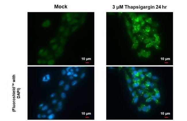 SQSTM1 Antibody in Immunocytochemistry (ICC/IF)