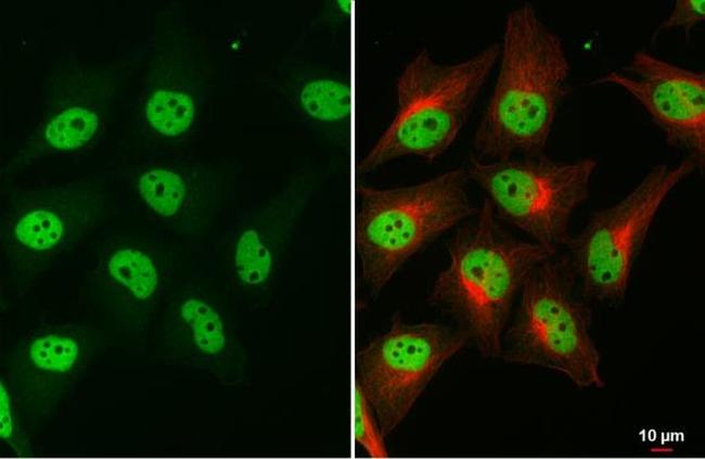 SMARCA2 Antibody in Immunocytochemistry (ICC/IF)