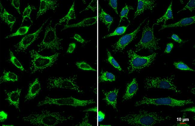 SDHA Antibody in Immunocytochemistry (ICC/IF)