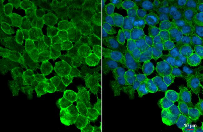 ZO-1 Antibody in Immunocytochemistry (ICC/IF)