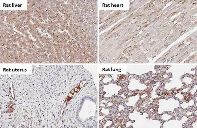 C1 inhibitor Antibody in Immunohistochemistry (Paraffin) (IHC (P))