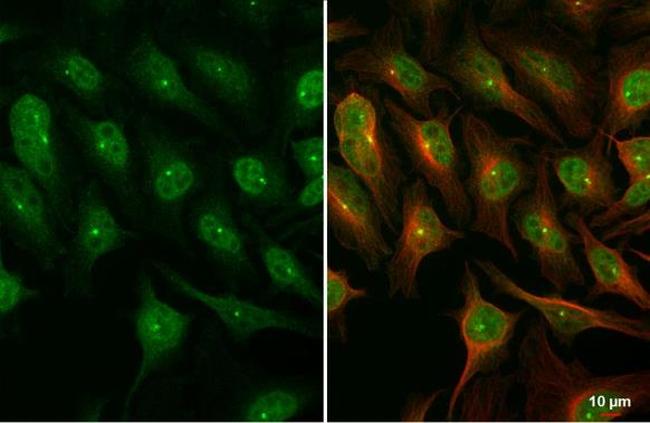 DUT Antibody in Immunocytochemistry (ICC/IF)