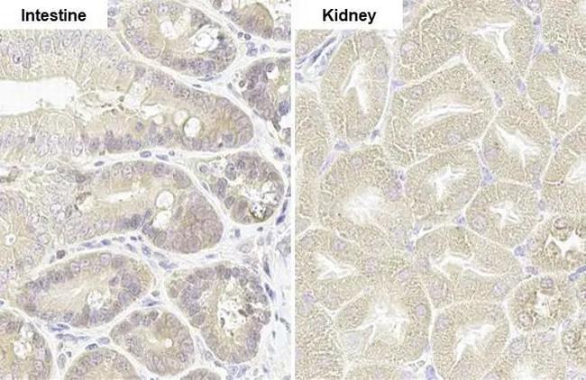 RRM1 Antibody in Immunohistochemistry (Paraffin) (IHC (P))