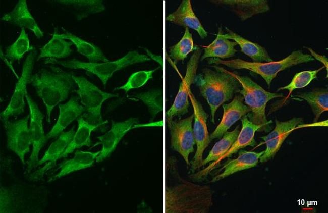 Dicer Antibody in Immunocytochemistry (ICC/IF)