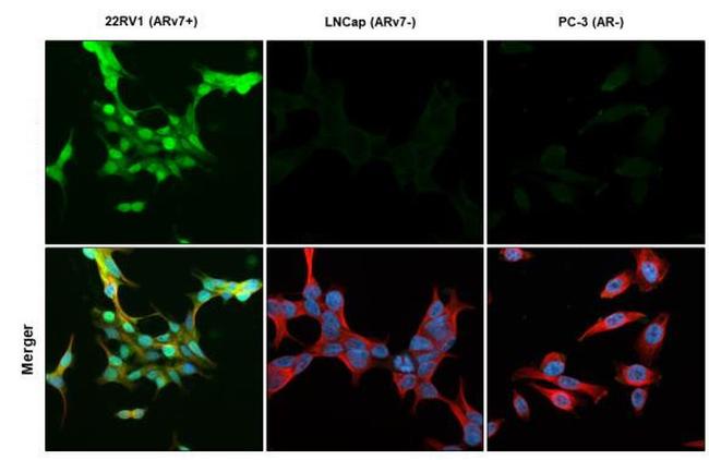 Androgen Receptor (ARv7 Splice Variant) Antibody in Immunocytochemistry (ICC/IF)