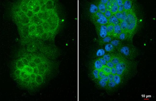 CYLD Antibody in Immunocytochemistry (ICC/IF)