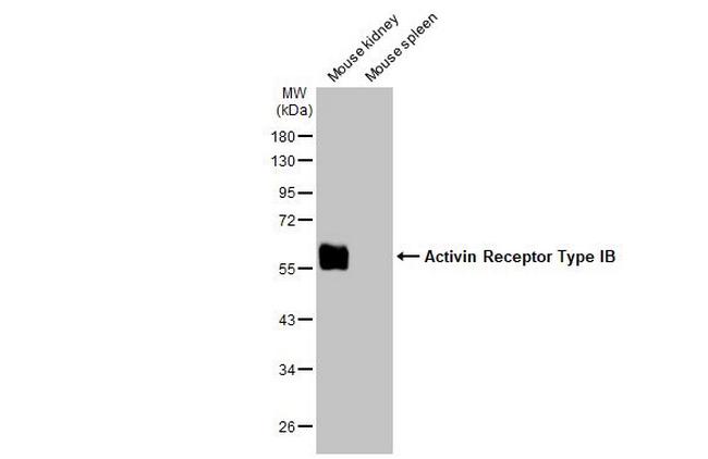 ACVR1B Antibody in Western Blot (WB)