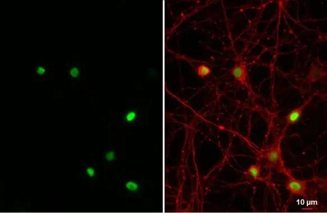 NFIX Antibody in Immunocytochemistry (ICC/IF)