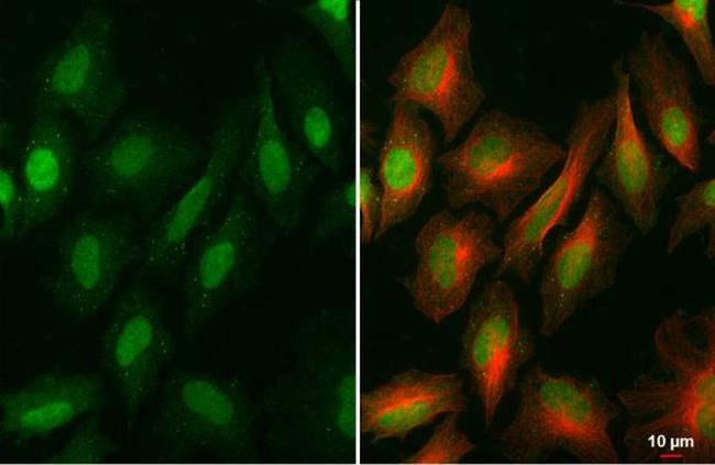 BRD9 Antibody in Immunocytochemistry (ICC/IF)