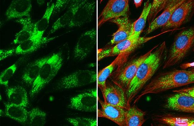 COL4A1 Antibody in Immunocytochemistry (ICC/IF)